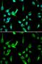DNA Topoisomerase II Binding Protein 1 antibody, GTX16438, GeneTex, Immunofluorescence image 