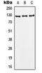 Leptin Receptor antibody, MBS821996, MyBioSource, Western Blot image 