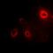 Ribosomal Protein Lateral Stalk Subunit P1 antibody, abx142202, Abbexa, Western Blot image 