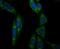 Aconitase antibody, A03096, Boster Biological Technology, Immunocytochemistry image 