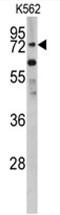 Zinc Finger And BTB Domain Containing 16 antibody, AP17652PU-N, Origene, Western Blot image 