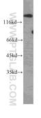 SDC antibody, 60185-2-Ig, Proteintech Group, Western Blot image 