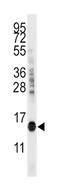 Cytidine deaminase antibody, abx031759, Abbexa, Western Blot image 