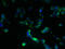 Zinc Finger DHHC-Type Containing 5 antibody, orb357683, Biorbyt, Immunofluorescence image 