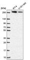 CAD protein antibody, PA5-66070, Invitrogen Antibodies, Western Blot image 