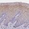 Multivesicular Body Subunit 12A antibody, PA5-59924, Invitrogen Antibodies, Immunohistochemistry paraffin image 