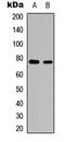 REL Proto-Oncogene, NF-KB Subunit antibody, LS-C358848, Lifespan Biosciences, Western Blot image 