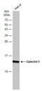 Galectin 1 antibody, GTX634454, GeneTex, Western Blot image 
