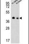 TPC antibody, PA5-25193, Invitrogen Antibodies, Western Blot image 