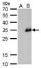 Neurogenin 1 antibody, GTX129223, GeneTex, Western Blot image 