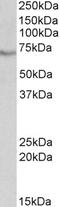 BIRC3 antibody, EB10370, Everest Biotech, Western Blot image 