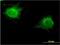Zinc Finger Protein 239 antibody, H00008187-M27, Novus Biologicals, Immunocytochemistry image 