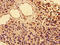 CD25 antibody, orb400860, Biorbyt, Immunohistochemistry paraffin image 