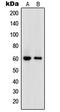 DNA Polymerase Epsilon 2, Accessory Subunit antibody, LS-C352677, Lifespan Biosciences, Western Blot image 