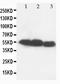 Matrix Metallopeptidase 8 antibody, PA1207, Boster Biological Technology, Western Blot image 