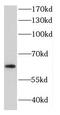 ATP-dependent RNA helicase DDX3X antibody, FNab02305, FineTest, Western Blot image 