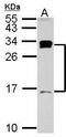 Nuclear nucleic acid-binding protein C1D antibody, GTX102013, GeneTex, Western Blot image 