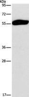 Sperm Associated Antigen 6 antibody, PA5-50556, Invitrogen Antibodies, Western Blot image 