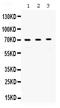 Replication Protein A1 antibody, PB9886, Boster Biological Technology, Western Blot image 