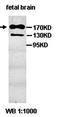 Poly(ADP-Ribose) Polymerase Family Member 14 antibody, orb76945, Biorbyt, Western Blot image 