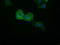 Chromosome 16 Open Reading Frame 72 antibody, TA501562, Origene, Immunofluorescence image 