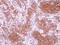 Cell death activator CIDE-3 antibody, GTX116733, GeneTex, Immunohistochemistry paraffin image 