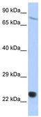 SP110 Nuclear Body Protein antibody, TA331675, Origene, Western Blot image 