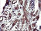 Uracil Phosphoribosyltransferase Homolog antibody, LS-C338232, Lifespan Biosciences, Immunohistochemistry paraffin image 