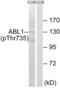 ABL Proto-Oncogene 1, Non-Receptor Tyrosine Kinase antibody, abx012591, Abbexa, Western Blot image 