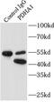Pyruvate Dehydrogenase E1 Alpha 1 Subunit antibody, FNab06269, FineTest, Immunoprecipitation image 