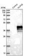 Nucleoporin 35 antibody, NBP1-92213, Novus Biologicals, Western Blot image 