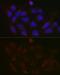 Polypeptide N-acetylgalactosaminyltransferase 3 antibody, GTX66226, GeneTex, Immunocytochemistry image 
