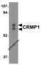 Dihydropyrimidinase-related protein 1 antibody, 3625, ProSci Inc, Western Blot image 