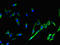 SH2 Domain Containing 1A antibody, orb46083, Biorbyt, Immunocytochemistry image 