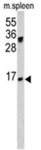 Joining Chain Of Multimeric IgA And IgM antibody, AP17496PU-N, Origene, Western Blot image 