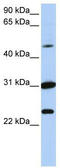 X-Linked Kx Blood Group antibody, TA334281, Origene, Western Blot image 