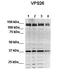 VPS26A antibody, orb331143, Biorbyt, Western Blot image 