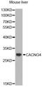 Calcium Voltage-Gated Channel Auxiliary Subunit Gamma 4 antibody, STJ29725, St John