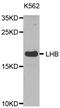 Luteinizing Hormone Beta Polypeptide antibody, MBS127803, MyBioSource, Western Blot image 