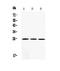 Superoxide Dismutase 2 antibody, LS-C312936, Lifespan Biosciences, Western Blot image 
