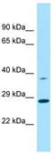 CLL-1 antibody, TA333920, Origene, Western Blot image 