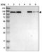 Huntingtin Interacting Protein 1 antibody, NBP1-81593, Novus Biologicals, Western Blot image 