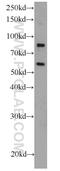 SGK antibody, 23394-1-AP, Proteintech Group, Western Blot image 