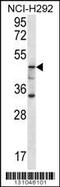 Glucosylceramidase Beta 3 (Gene/Pseudogene) antibody, 56-324, ProSci, Western Blot image 