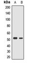Ras Association Domain Family Member 6 antibody, LS-C668952, Lifespan Biosciences, Western Blot image 