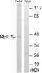 Nei Like DNA Glycosylase 1 antibody, LS-C119957, Lifespan Biosciences, Western Blot image 