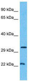 Ribosomal Oxygenase 2 antibody, TA329646, Origene, Western Blot image 