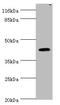 Ubiquitin Specific Peptidase 12 antibody, A50588-100, Epigentek, Western Blot image 