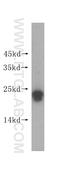 RAB22A, Member RAS Oncogene Family antibody, 16181-1-AP, Proteintech Group, Western Blot image 