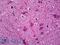 Neurotrimin antibody, LS-B5442, Lifespan Biosciences, Immunohistochemistry paraffin image 